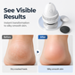 🔥 50 % RABATT – KUN I BEGRENSET TID!🔥Profesjonell elektrisk barbermaskin for fothår